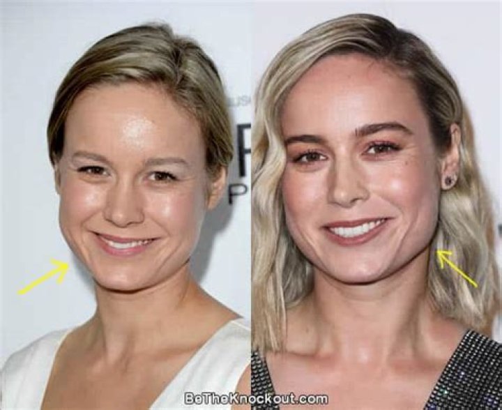 Did Brie Larson Undergo Plastic Surgery? Before and After