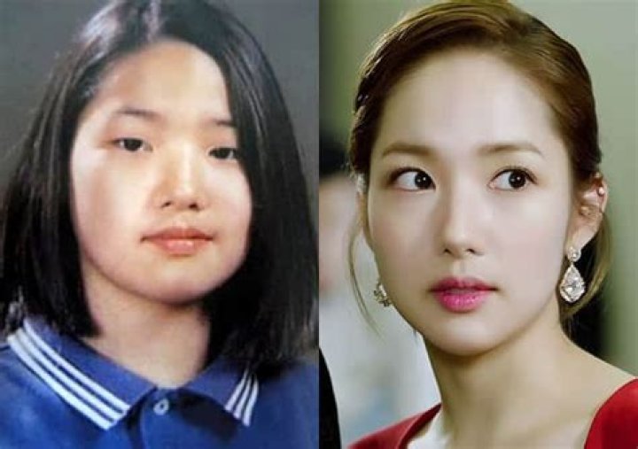 Did Park Min Young Have Plastic Surgery? Park Min Young Before and After Did Park Min Young Have Plastic Surgery? Park Min Young Before and After