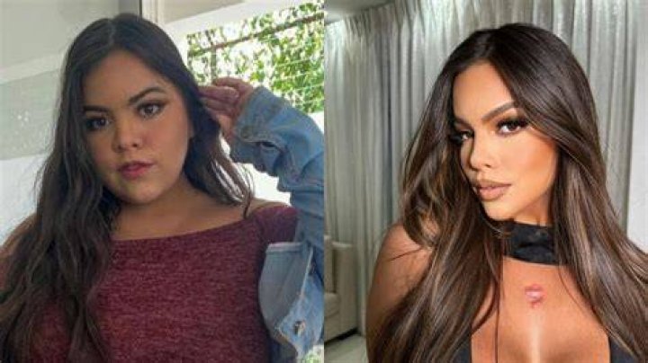Gracie Bon Plastic Surgery Her Transformation Revealed