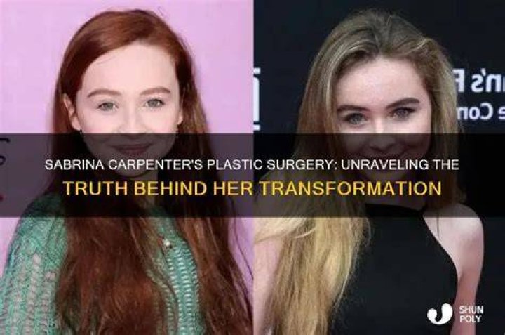 Unveiling The Truth: Did Sabrina Carpenter Get Surgery?